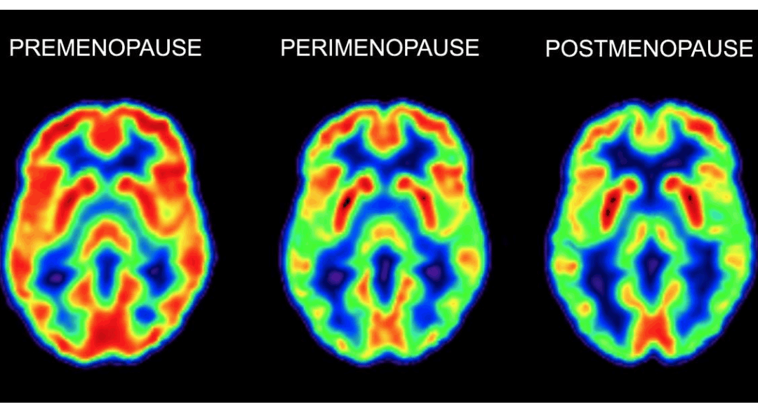 Claridad mental en la menopausia: cómo recuperar concentración