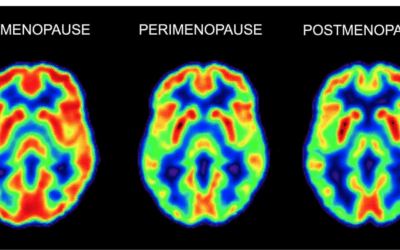 Claridad mental en la menopausia: cómo recuperar concentración